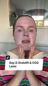 Tips for Wallpapering a Ceiling Like a Pro