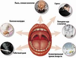 Bol V Gorle Bolno Glotat Simptomy Pochemu Bolit Gorlo Oslozhneniya Lechenie