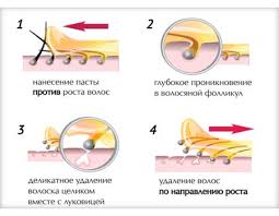 Удаление нежелательных волос сахарной пастой является одним из древнейших ритуалов красоты. Saharnaya Epilyaciya Sekret Krasoty Caric