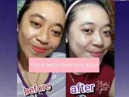 My skin care routine used to be a bit hit and miss. About Trulum By Trulumasia Com Kulit Adalah Perisai Terluar Jaringan Tubuh Yang Membutuhkan Perhatian Khusus Ba Incoming Call Screenshot Incoming Call Tlam