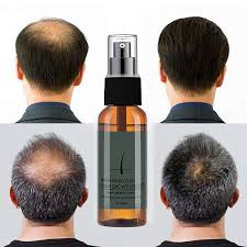 All of my thin spots are gone! Romantic Bear Romantic Bear Hair Growth Essential Oil Essence Anti Hair Loss Liquid Beauty Dense Hair Essential Oil 30ml By Romantic Bear Shop Online For Beauty In The United States