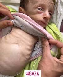 shuen 🐽 (@depresshuen)