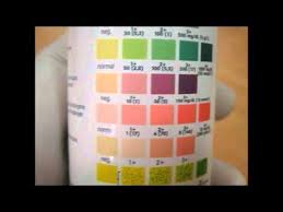 Urine Routine Microscopic Rapid Strip Test Youtube