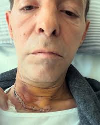 Fundraiser for Bella Younger by Jeremy Mount : Ben's Road to Recovery