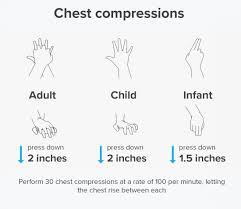 How To Perform Cpr Guidelines Procedure And Ratio