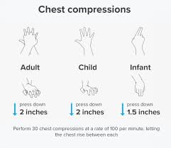 how to perform cpr guidelines procedure and ratio