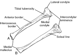 Malleolus coronal section through right talocrural and talocalcaneal joints. Tibia Bone Medical Dictionary Medical Terms Ankle Anatomy