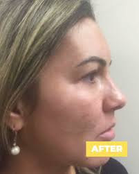 Summer Ready Supplement