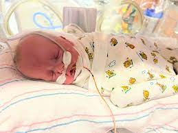 Zoey has had a hard few days with her bradys and desats. Her head is now up 2.5cm so it's measuring 30cm. She has been very agitated and mad. Tachycardic. Just all