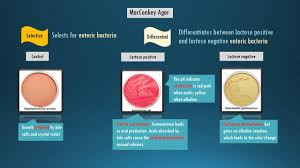 Selective Media Microbiology Test Related Keywords