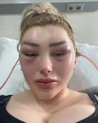 Beverly Bustamante's Instagram, Twitter & Facebook