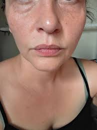 What to do for a migraine?