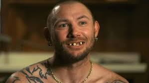 Ufc's anthony smith teeth knocked out, face broken in. Anthony Smith Right Now Ufc