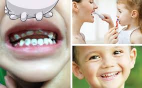 Check spelling or type a new query. Kerosakan Gigi Kanak Kanak Mencegah Adalah Lebih Baik Daripada Merawat Free Malaysia Today Fmt