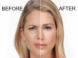Dec 05, 2018 · there is no tangible difference in longevity between xeomin and botox. Botox Dysport Jeuveau Xeomin Proactive Aging Med Spa In Greenwood Village Colorado