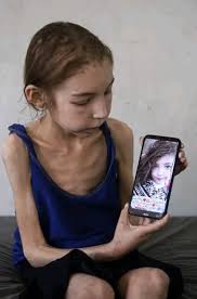 The Hypocrisy of the West and the Mass Media: Starvation Lies and Hostage  Truths  https://matthewnarhtetteh.com/the-hypocrisy-of-the-west-and-the-mass-media-starvation-lies-and-hostage-truths/ 