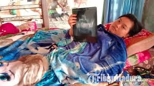 Profil sekolah sd, sekolah data kemdikbud go id, cara melihat nss sekolah secara online, profil. Kronologi Lengkap Siswi Sman 1 Pademawu Patah Tulang Pinggang Dijaili Teman Bercandanya Keterlaluan Halaman All Tribun Madura