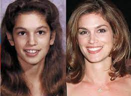 Cristiano ronaldo is one of football's most famous faces — yet he has transformed it over the years. Cristiano Ronaldo Tom Cruise Emma Watson And 4 More Celebrities Who Wore Dental Braces To Fix Their Teeth South China Morning Post