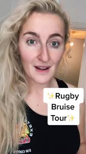 ✨RUGBY BRUISE TOUR✨ Where have you had weird & whacky scratches/bruises?  #theproplife #proplife01 #proplife #rugby #rugbytok #womensrugby
