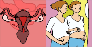 6 Concerning Symptoms Of Ovarian Cysts Women Of All Ages Need To Know About Ovarian Cyst Symptoms Remedies For Menstrual Cramps Severe Menstrual Cramps
