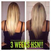 Biotin Hair Vitamins Before And After Our Hair Skin Nails Rocks Want To See Your Own Results Hair Skin Nails Is Just 33 For Loyal Custom Hair Skin Nails Vitamins Hair Skin Nails Long Hair Styles