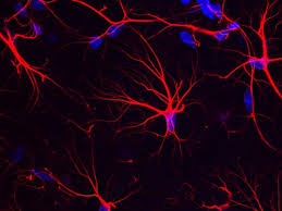 C'est cette piste que suivent des chercheurs de l'université de manchester pour élaborer un traitement contre la maladie d'alzheimer. Alzheimer Decouverte D Un Acide Amine Pour La Memoire Sciences Et Avenir