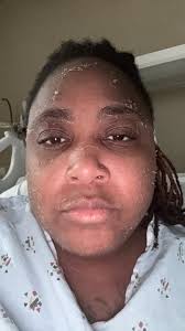 I've had SLE since March 2015 and January 2025 I got diagnosed with ILD-  Lung Disease 6 months later they finally saying it's Lupus Related 🤦🏾‍♂️…  The Storms Don't Last Long. Lets