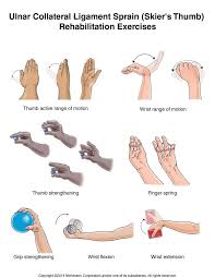 Check spelling or type a new query. Summit Medical Group Skier S Thumb Ulnar Collateral Ligament Sprain Exercises Physical Therapy Exercises Hand Therapy Exercise