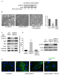 Each of us has trillions of cells, as does a growing tree. P130cas Cyclooxygenase 2 Axis In The Control Of Mesenchymal Plasticity Of Breast Cancer Cells Breast Cancer Research Full Text