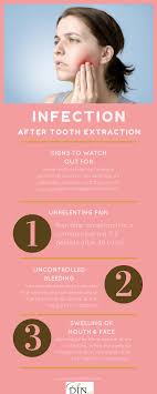 Do i need to come back? Signs Of Infection After A Tooth Extraction Ala Din Dds