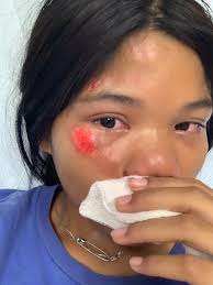 Two individuals stole the catalytic converter from my nephew's 2008 Honda  Element