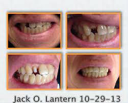 Pin On Dentistry