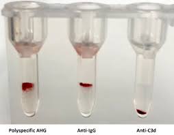 Image result for Direct Coombs