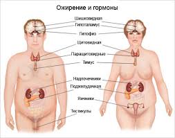 Gormonalnoe Endokrinnoe Ozhirenie Prichiny Simptomy I Sposoby Lecheniya U Zhenshin Klassifikaciya Bolezni I Osobennosti Vybora Lekarstv