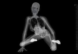 X-Ray Pinup Girls Are Just Pixels (NSFW?) | WIRED