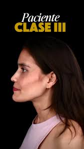 Bienvenidos a Felipe Nava Orthodontics and Smile Desing En este espacio  encontrarás todas las especialidades odontológicas 💎 #porcelainveneers  #ortodonciainvisible #flowjac #invisaling #ortodonciacali #ondontologiacali