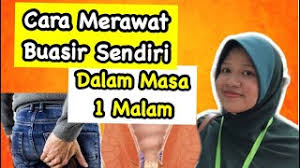 Cara merawat buasir gejala penyakit ini seringkali boleh sembuh selepas beberapa hari tanpa memerlukan rawatan. Propolis Untuk Buasir Resipi Untuk Krim Tincture Supositoria Di Rumah Petua Dan Cara 2021