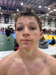 Heck of a weekend for Dylan Padgett. Finishing 2nd today. He went 10-1 this  weekend. Took out 2 state champions (majored 5a state champ 12-2 from cox  and beat a North Carolina