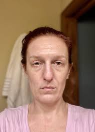 The past 3ish years have not been good to me emotionally. It's really  showing in my face. I'd like to reverse/slow down signs of aging if  possible. I have no idea where