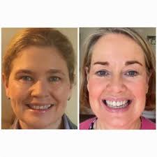 University of the Third Age