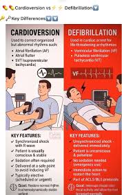 Image result for Synchronized Cardioversion