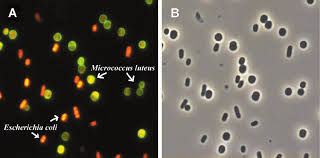 Mixed Culture 1 1 Of M Luteus Gram Positive Cocci And E