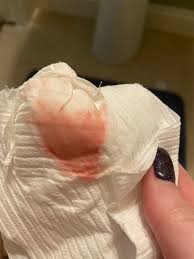 Image result for First Trimester Bleeding