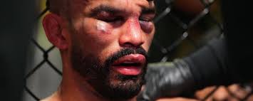 Rob Font (Peso galo) Perfil do MMA