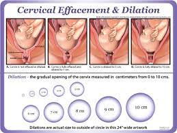 1cm 50 Effaced Cervix High And Baby Is 3 What Does All That Mean September 2016 Babies Forums What To Expect