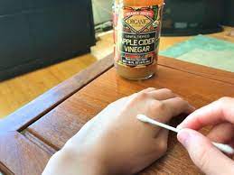 How To Make A Homemade Bed Bug Killer Spray With Vinegar Dengarden