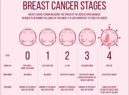 It can be fairly subtle. Oncolytics Biotech On Twitter Breast Cancer How Fast Does It Spread Mnt Has Great Overview Including Symptoms Diagnosis Treatment And Outlook Https T Co Ejdkvgvcnr Https T Co 1hpkucn5io Twitter
