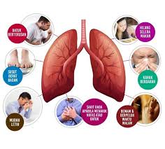 Minum seperti minum obat batuk sirup secara rutin setiap hari. Batuk Berpanjangan