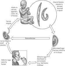 Image result for Pinworm