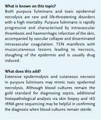 Mental status, stroke purpura fulminans: Article Purpura Fulminans Mimicking Toxic Epidermal Necrolysis Additional Value Of 16s Rrna Sequencing And Skin Biopsy Full Text May 2017 Njm